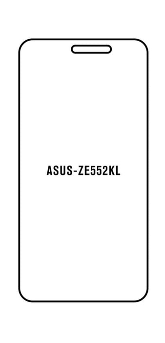 Asus ZE552KL | Meilleure Protection (Avant)